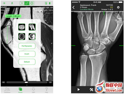 迎来全新拐点 智能医疗行业正风生水起