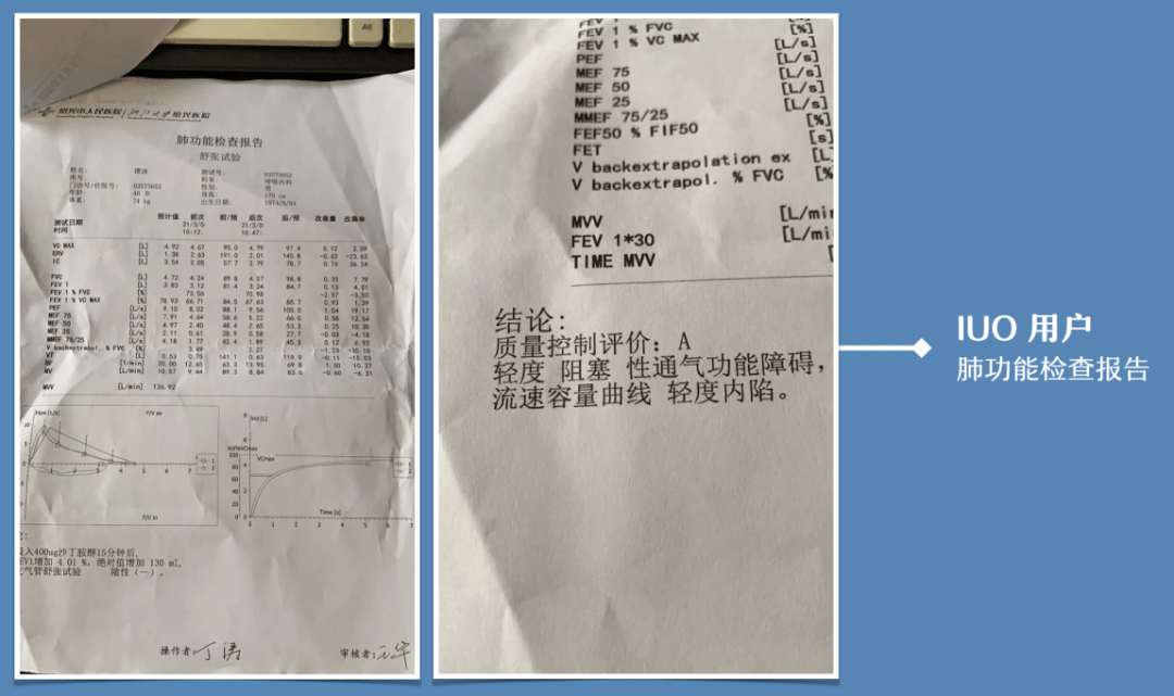 余看智能启动IUO烟斗对慢阻肺有效医理研究